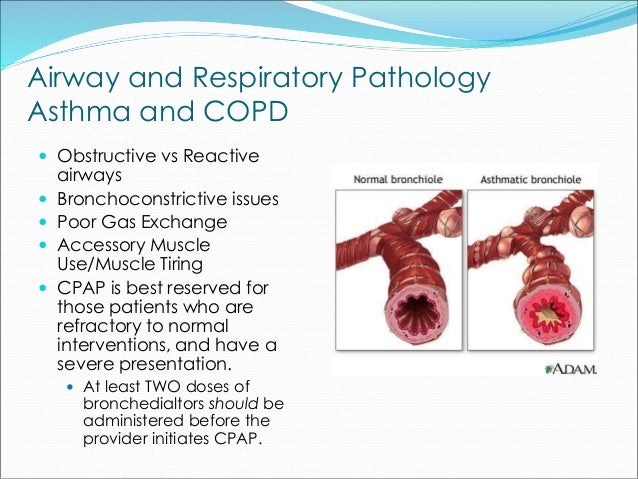 Solumedrol Methylprednisolone Sodium Succinate Dose