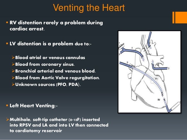 Cardiopulmonary Bypass