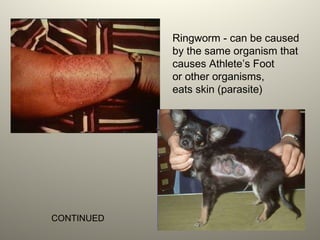 Ringworm - can be caused
by the same organism that
causes Athlete’s Foot
or other organisms,
eats skin (parasite)
CONTINUED
 
