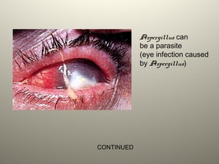 Aspergillus can
be a parasite
(eye infection caused
by Aspergillus)
CONTINUED
 