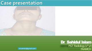 Dr Sahidul Islam
PGTRadiology(1styr)
FAAMCH
Case presentation
dr.sahidul@gmail.com
 