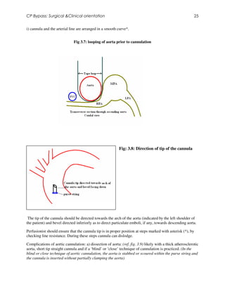 Stebbed String Cpb surgical&clinical orientation | PDF