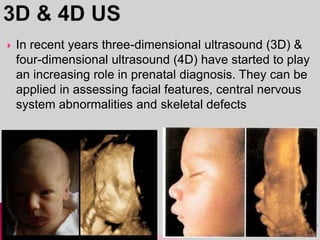  In recent years three-dimensional ultrasound (3D) &
four-dimensional ultrasound (4D) have started to play
an increasing role in prenatal diagnosis. They can be
applied in assessing facial features, central nervous
system abnormalities and skeletal defects
34
 