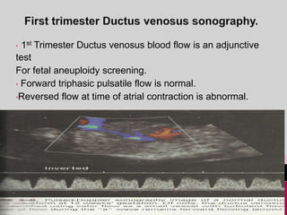 • 1st Trimester Ductus venosus blood flow is an adjunctive
test
For fetal aneuploidy screening.
• Forward triphasic pulsatile flow is normal.
•Reversed flow at time of atrial contraction is abnormal.
 