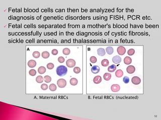  Fetal blood cells can then be analyzed for the
diagnosis of genetic disorders using FISH, PCR etc.
 Fetal cells separated from a mother's blood have been
successfully used in the diagnosis of cystic fibrosis,
sickle cell anemia, and thalassemia in a fetus.
A. Maternal RBCs B. Fetal RBCs (nucleated)
52
 