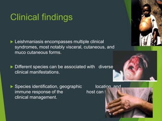Clinical findings
 Leishmaniasis encompasses multiple clinical
syndromes, most notably visceral, cutaneous, and
muco cutaneous forms.
 Different species can be associated with diverse
clinical manifestations.
 Species identification, geographic location, and
immune response of the host can facilitate
clinical management.
 