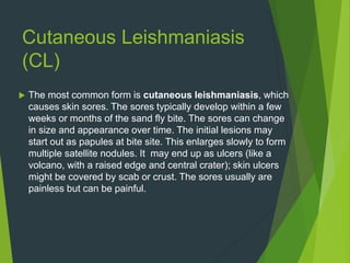 Cutaneous Leishmaniasis
(CL)
 The most common form is cutaneous leishmaniasis, which
causes skin sores. The sores typically develop within a few
weeks or months of the sand fly bite. The sores can change
in size and appearance over time. The initial lesions may
start out as papules at bite site. This enlarges slowly to form
multiple satellite nodules. It may end up as ulcers (like a
volcano, with a raised edge and central crater); skin ulcers
might be covered by scab or crust. The sores usually are
painless but can be painful.
 