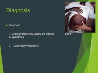 Diagnosis
 Includes:
1. Clinical diagnosis based on clinical signs
& symptoms
2. Laboratory diagnosis
 