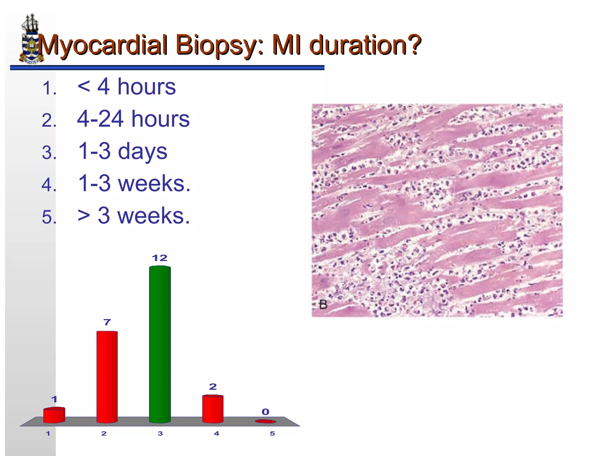 Rd Infraction Example Myocardial Infarction Pathology Pathology Of Myocardial Infarction