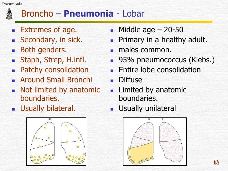Types Of Pneumonia Lobar - bronchitis contagious