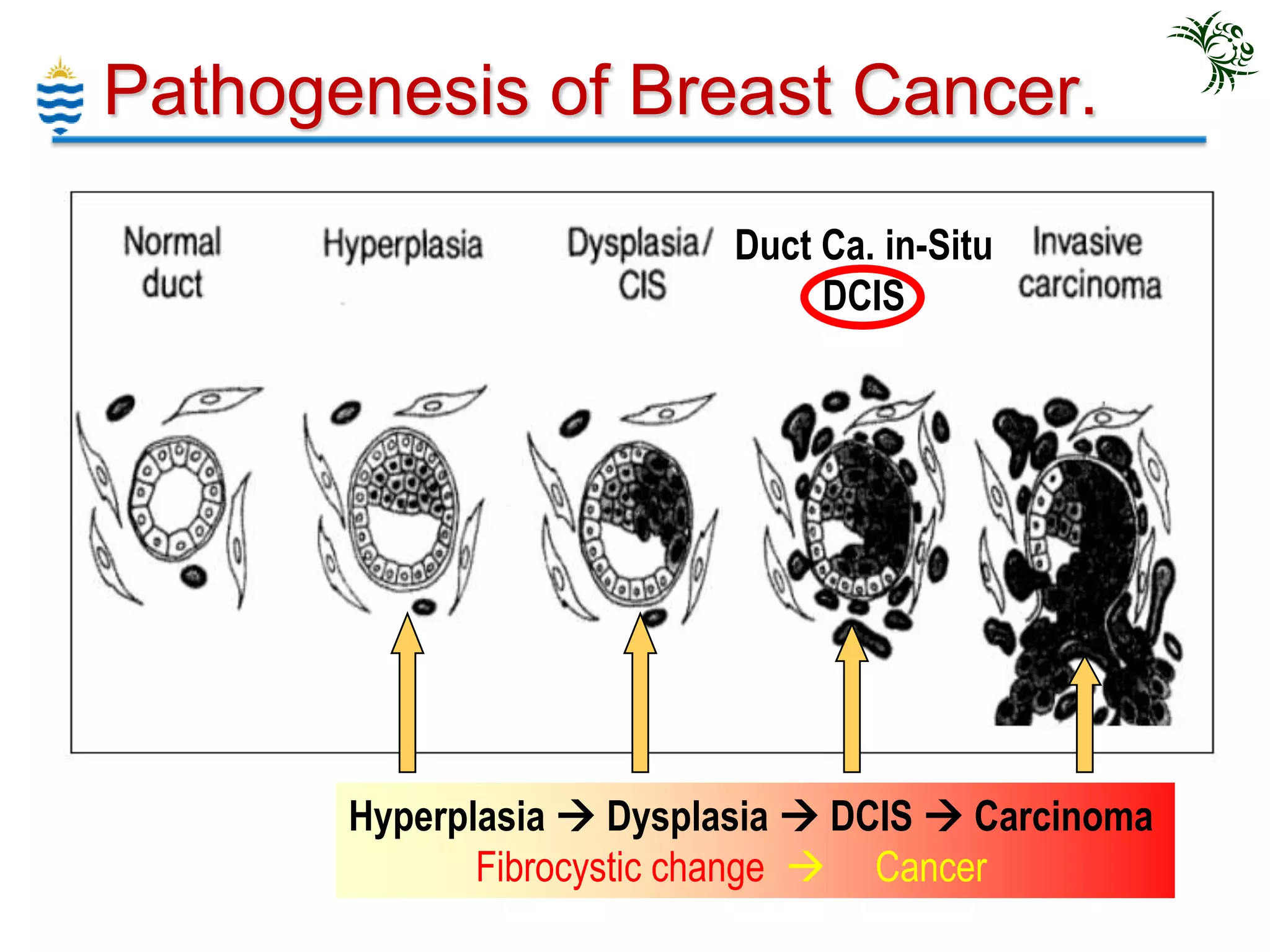 Breast Pathology Lecture - 2013 | PPTX