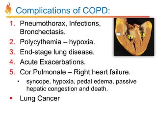 Complications of COPD: 
1. Pneumothorax, Infections, 
Bronchectasis. 
2. Polycythemia – hypoxia. 
3. End-stage lung disease. 
4. Acute Exacerbations. 
5. Cor Pulmonale – Right heart failure. 
• syncope, hypoxia, pedal edema, passive 
hepatic congestion and death. 
 Lung Cancer 
RV 
LV 
 