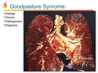 Goodpasture Synrome: 
? Etiology 
? Clinical 
?Pathogenesis 
? Diagnosis. 
 