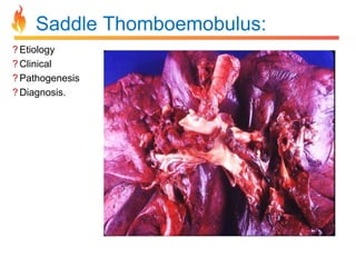 Saddle Thomboemobulus: 
? Etiology 
? Clinical 
?Pathogenesis 
? Diagnosis. 
 