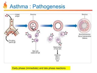 Asthma : Pathogenesis 
Early phase (immediate) and late phase reactions 
 