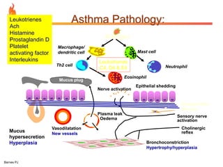 Asthma Pathology: 
Barnes PJ 
Allergen 
Mucus 
hypersecretion 
Hyperplasia 
Leukotrienes 
C4, D4 & E4 
Th2 cell Neutrophil 
Vasodilatation 
New vessels 
Plasma leak 
Oedema 
Subepithelial 
fibrosis 
Sensory nerve 
activation 
Cholinergic 
reflex 
Mast cell 
Bronchoconstriction 
Hypertrophy/hyperplasia 
Eosinophil 
Macrophage/ 
dendritic cell 
Mucus plug 
Epithelial shedding 
Nerve activation 
Leukotrienes 
Ach 
Histamine 
Prostaglandin D 
Platelet 
activating factor 
Interleukins 
 