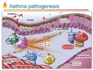 Asthma pathogenesis: 
 