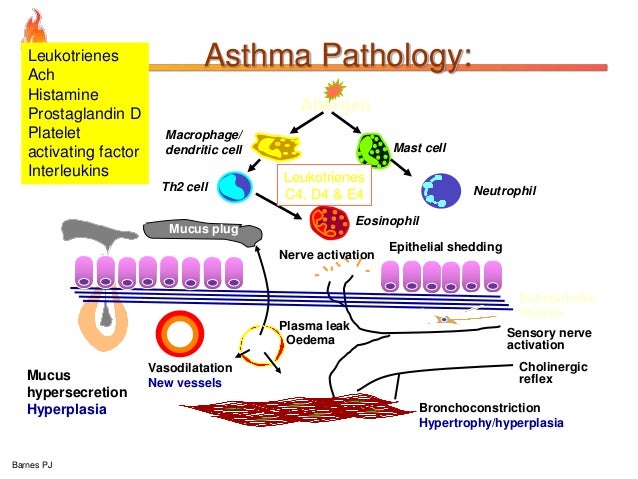 Describe The Pathophysiology Of Asthma – VCOG