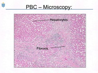 PBC – Microscopy:
 