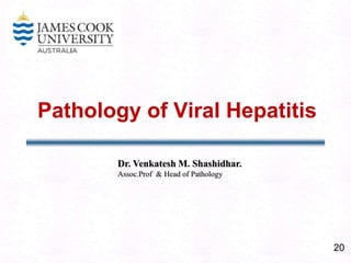 20
Pathology of Viral Hepatitis
Dr. Venkatesh M. Shashidhar.
Assoc.Prof & Head of Pathology
 