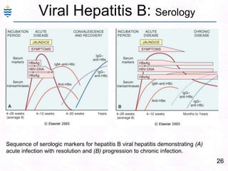 26
Viral Hepatitis B: Serology
Sequence of serologic markers for hepatitis B viral hepatitis demonstrating (A)
acute infection with resolution and (B) progression to chronic infection.
 