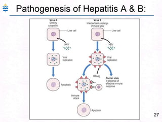 27
Pathogenesis of Hepatitis A & B:
 