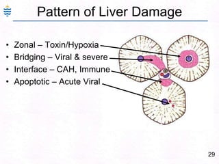 29
Pattern of Liver Damage
• Zonal – Toxin/Hypoxia
• Bridging – Viral & severe
• Interface – CAH, Immune
• Apoptotic – Acute Viral
 