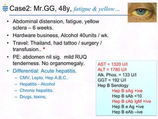 Case2: Mr.GG, 48y, fatigue & yellow…
• Abdominal distension, fatigue, yellow
sclera – 6 weeks.
• Hardware business, Alcohol 40units / wk.
• Travel: Thailand, had tattoo / surgery /
transfusion.. *
• PE: abdomen nil sig. mild RUQ
tenderness. No organomegaly.
• Differential: Acute hepatitis.
– CMV, Lepto, Hep A,B,C..
– Hepatitis - Alcohol
– Chronic hepatitis.
– Drugs, toxins,
3
AST = 1320 U/l
ALT = 1780 U/l
Alk. Phos. = 133 U/l
GGT = 192 U/l
Hep B Serology
Hep B sAg +ive
Hep B sAb <10
Hep B cAb IgM +ive
Hep B e Ag +ive
Hep B eAb –ive
 
