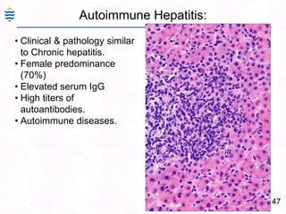 Autoimmune Hepatitis:
47
• Clinical & pathology similar
to Chronic hepatitis.
• Female predominance
(70%)
• Elevated serum IgG
• High titers of
autoantibodies.
• Autoimmune diseases.
 