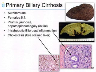 Primary Biliary Cirrhosis
• Autoimmune.
• Females 6:1.
• Pruritis, jaundice,
hepatosplenomegaly (initial).
• Intrahepatic Bile duct inflammation
• Cholestasis (bile stained liver)
64
 