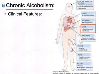 74
Chronic Alcoholism:
• Clinical Features:
 
