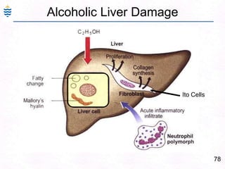 78
Alcoholic Liver Damage
Ito Cells
 