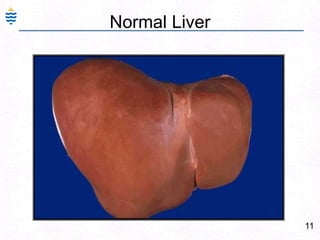 11Normal Liver