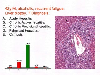 92Cirrhosis End stage of diffuse liver disease. scaring with regenerating nodules. (liver failure)Normal        Cirrhosis 