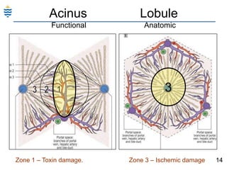 14Acinus			LobuleFunctional 	 		 Anatomic3Zone 1 – Toxin damage.    		Zone 3 – Ischemic damage