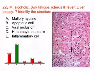 103Clinical FeaturesHepatic encephalopathy