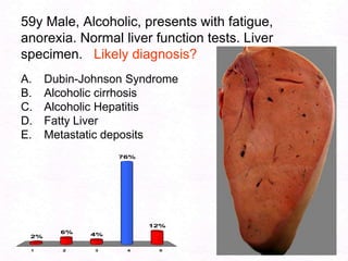 108Cirrhosis: