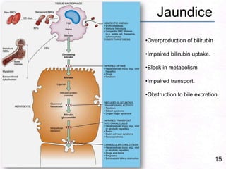 Jaundice15Overproduction of bilirubin 