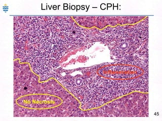 Hepatic encephalopathy 