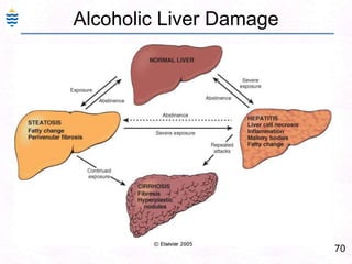 41Liver Biopsy – viral Hepatitis-C
