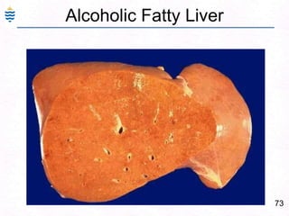 44Chronic Persistent Hepatitis: