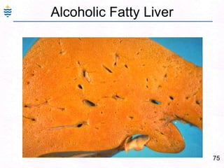 46Acute - Hepatitis - Chronic