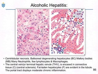 57Viral Hepatitis C: Serology