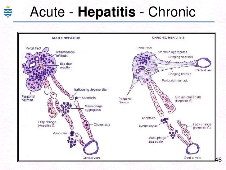 Pathology of Hepatitis