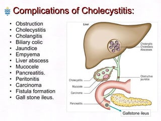 Complications of Cholecystitis: Obstruction  Cholecystitis  Cholangitis Biliary colic Jaundice Empyema Liver abscess Mucocele Pancreatitis. Peritonitis Carcinoma Fistula formation Gall stone ileus. Gallstone ileus 