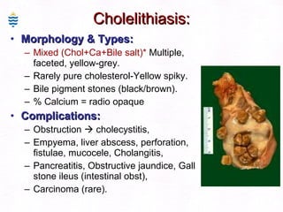 Cholelithiasis: Morphology & Types:  Mixed (Chol+Ca+Bile salt)*   Multiple, faceted, yellow-grey. Rarely pure cholesterol-Yellow spiky. Bile pigment stones (black/brown). % Calcium = radio opaque Complications:  Obstruction    cholecystitis, Empyema,  liver abscess,  perforation, fistulae,  mucocele, Cholangitis,  P ancreatitis,  Obstructive jaundice, Gall stone ileus (intestinal obst),  Carcinoma (rare). 
