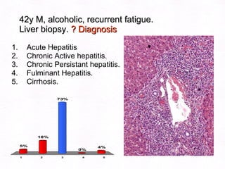42y M, alcoholic, recurrent fatigue.  Liver biopsy.  ? Diagnosis Acute Hepatitis Chronic Active hepatitis. Chronic Persistant hepatitis. Fulminant Hepatitis. Cirrhosis.   