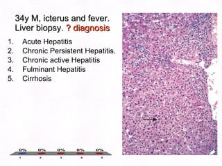 34y M, icterus and fever.  Liver biopsy.  ? diagnosis Acute Hepatitis Chronic Persistent Hepatitis. Chronic active Hepatitis Fulminant Hepatitis Cirrhosis   