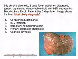 56y chronic alcoholic, 2 days fever, abdomen distended, tender, tap yielded cloudy yellow fluid with 98% neutrophils, Blood culture E.coli. Patient dies 3 days later. Image shows his liver.  Most Likely diagnosis? A1 antitrypsin deficiency HEV infection Hereditary hemochromatosis Primary sclerosing cholangitis Alcoholic cirrhosis 