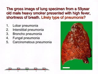 The gross image of lung specimen from a 59year old male heavy smoker presented with high fever, shortness of breath.  Likely type of pneumonia?   Lobar pneumonia Interstitial pneumonia   Broncho pneumonia Fungal pneumonia Carcinomatous pneumonia 